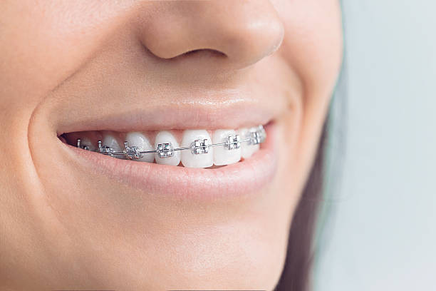 Dental Inlays and Onlays in Creston, OH